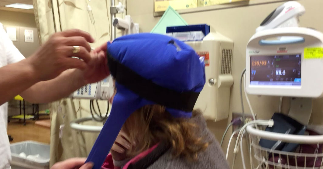 Cold Capping to Prevent Hair Loss in Chemotherapy